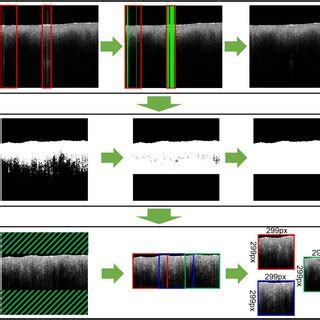 A Typical Spectral Domain OCT System Broadband Light Is Split Into