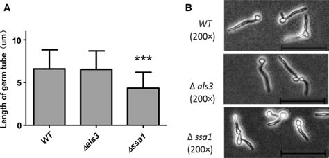 Germ Tubes Formation Of C Albicans Wild Type And Mutants The Average Download Scientific