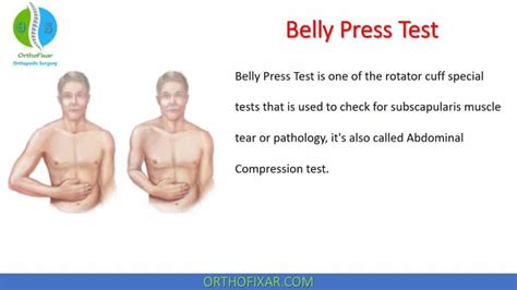 Numeric Pain Rating Scale NPRS Score OrthoFixar 2025