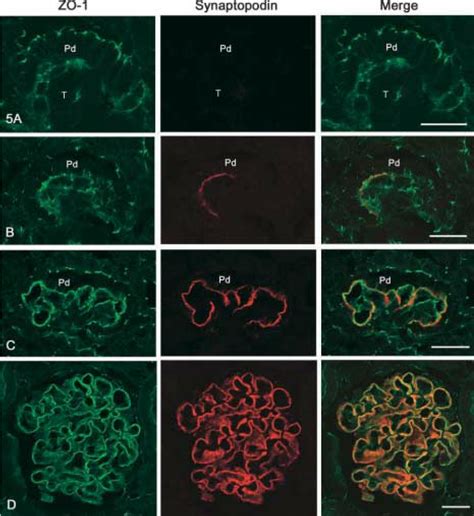 Confocal Laser Scanning Images Showing The Localization Of Synaptopodin