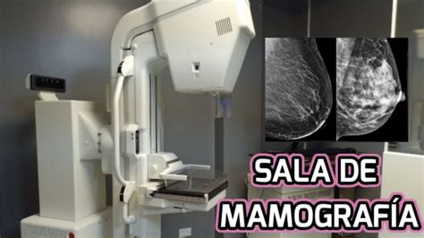 ASÍ es UNA SALA DE MAMOGRAFIA YouTube