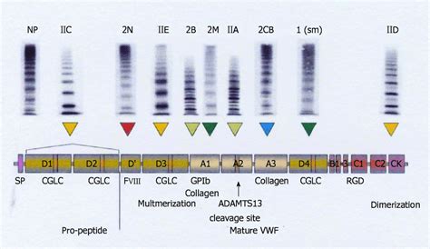 Multimeric Pattern Vwf From Plasma Of Patients With Von Willebrand Download Scientific Diagram