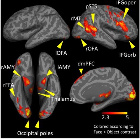 ROIs Regions Of Interest Used In The Present Study ROIs Were Defined