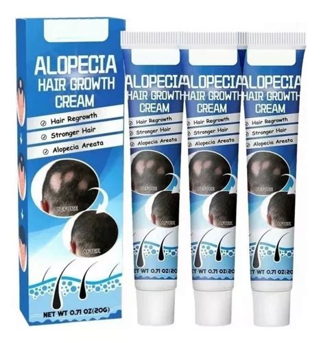 3×crema Para El Cuidado La Alopecia Areata Mercadolibre