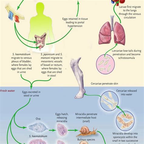 Strategies For Schistosomiasis Eradication Download Scientific Diagram