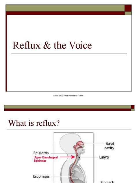 LPR | Gastroesophageal Reflux Disease | Heartburn