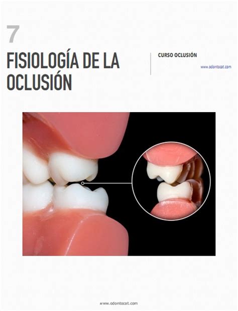 Odontocat Curso Online De Oclusi N