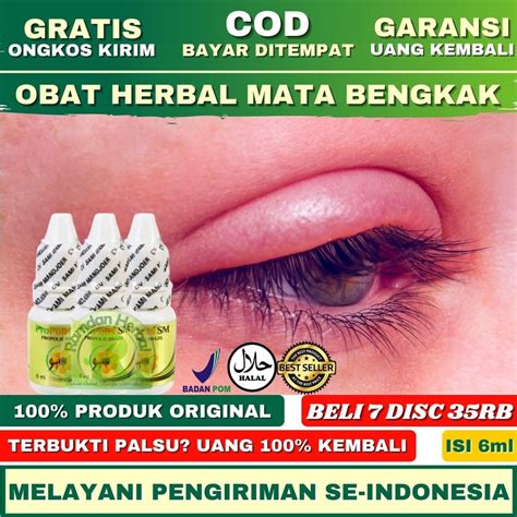 Jual Obat Oles Mata Bengkak Mata Bintitan Benjolan Di Kelopak Mata