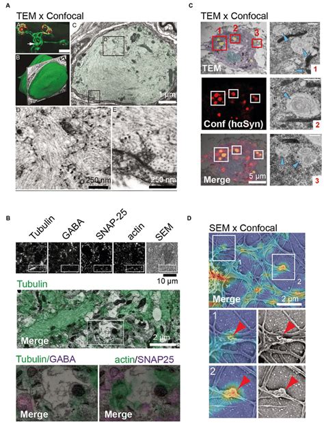 Examples Of In Situ And In Vitro Correlative Light Electron Microscopy