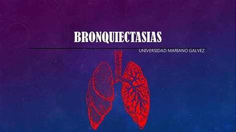 Bronquiectasias Luis Felipe Mazariegos UDocz