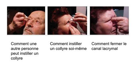 En Quoi Consiste Le Traitement Du Glaucome Belgian Glaucoma Society