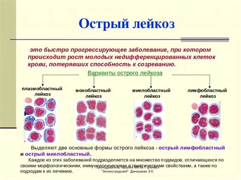 Хронический лейкоз чем отличается от острого симптомы заболевания и