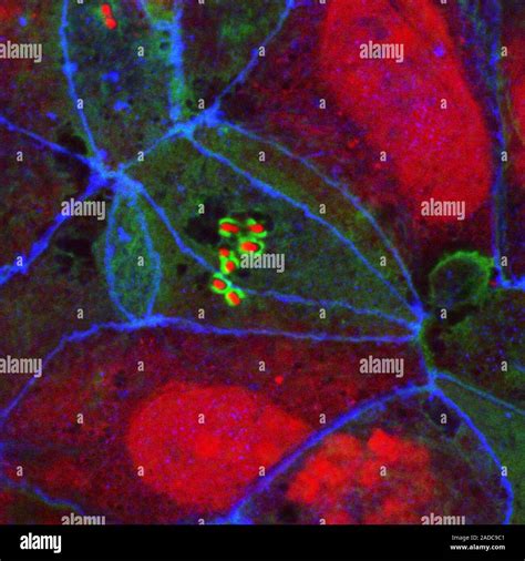 La Bacteria E Coli En El Intestino Delgado Micrograf A De Luz