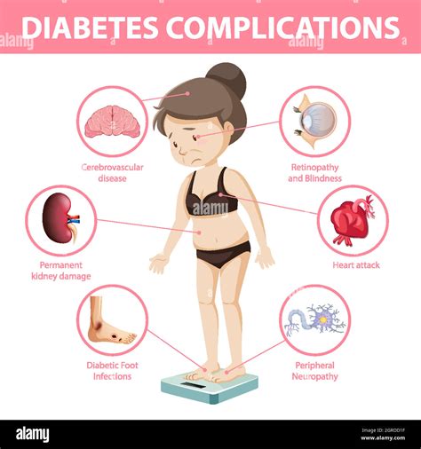 Infografía informativa sobre complicaciones de la diabetes Imagen