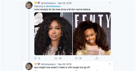 SZA Before Surgery: See the Singer's Drastic Transformation