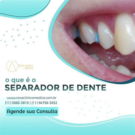 Pin De Hanan Hirzallah Em Dentist Blog De Receitas Dental Dentes