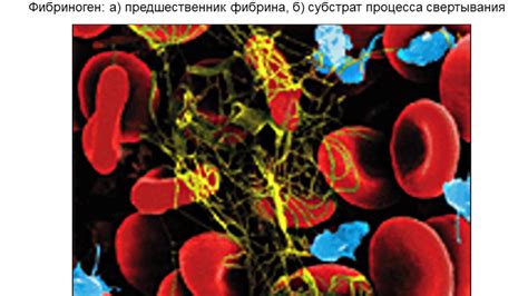 Фибриноген в кардиохирургии - YouTube