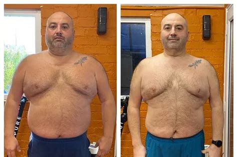 Go Compare Man Reveals Staggering 5 Stone Weight Loss After Falling