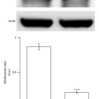 Klotho Protein Expressions In The Medulla Oblongata Of Stz Diabetic