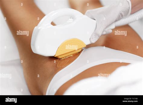 Picture Of Beautician Giving Epilation Laser Treatment To Woman On Bikini Stock Photo Alamy