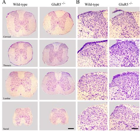 Morphology Of The Spinal Cord In Wild Type And Glur5 Open I