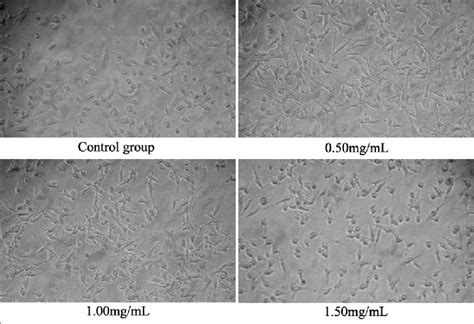 Cell Morphology Of MDA MB 231 Cells Treated With Different