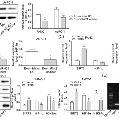 Downregulation Of Mir In Cancerassociated Fibroblasts Caf Exos