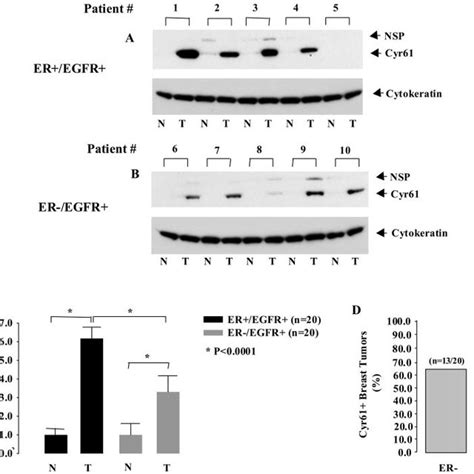 Analysis Of Cyr61 Protein Expression In Human Breast Tumors