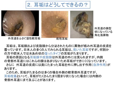 耳掃除について｜東京都世田谷区の耳鼻咽喉科 外科 内科「はたのクリニック」