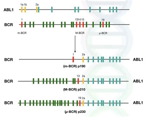 What Is Philadelphia Chromosome BCR ABL1 Gene Fusion And CML