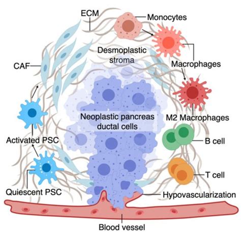 Pancreatic Cancer Organ Chip Models Encyclopedia Mdpi