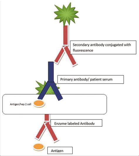 Anti Nuclear Antibodies A Practical Approach To Testing And