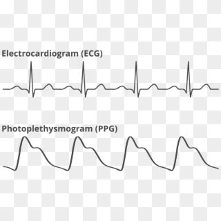 Reading The Data - Photoplethysmogram Waveform, HD Png Download - 1800x1000 (#1723088) - PinPng