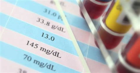 Calculate Cholesterol Ratios! LDL, Triglycerides & Total : HDL