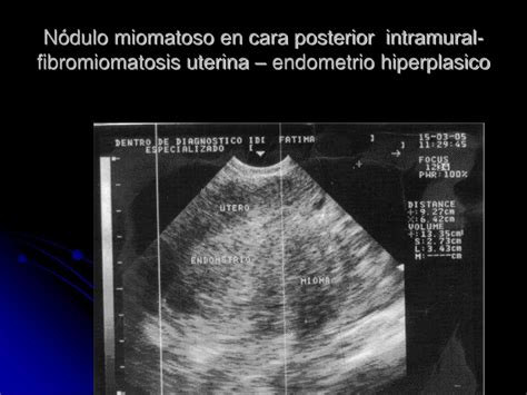 Ppt Primer Curso De Ecograf A Abdominal Auspiciado Por La Universidad