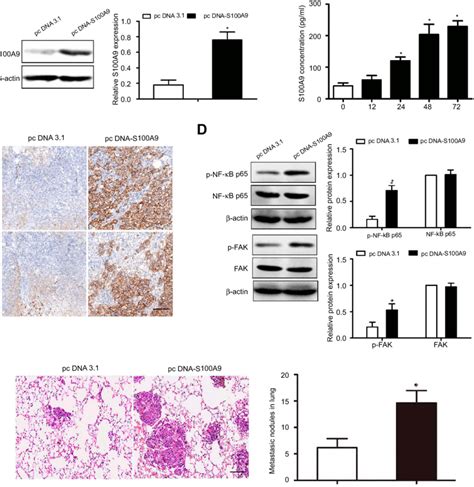 S100a9 Induces Prostate Cancer Cell Metastasis In Vivo Du 145 Cells