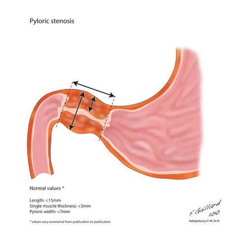 an image of the stomach showing what it looks like and how it's function