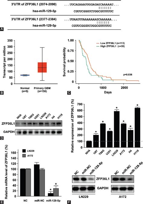 Overexpression Of Microrna 129 5p In Glioblastoma Inhibits Cell