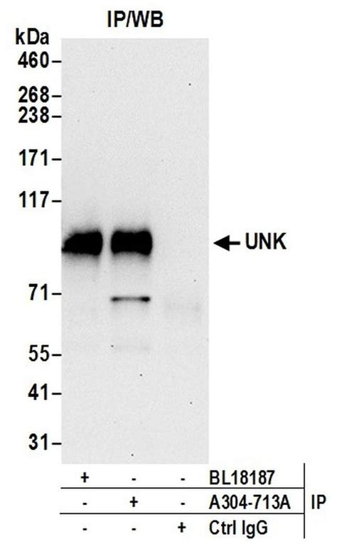 Unk Polyclonal Antibody A304 713a