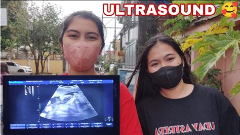 NAGPA ULTRASOUND NAKUSinamahan Ako Ni Jolina GIRL OR BOY Vlog 232