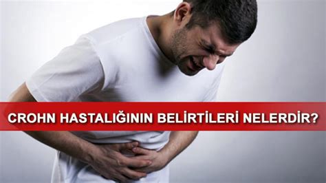 Crohn Hastal Nedir Belirtileri Nelerdir