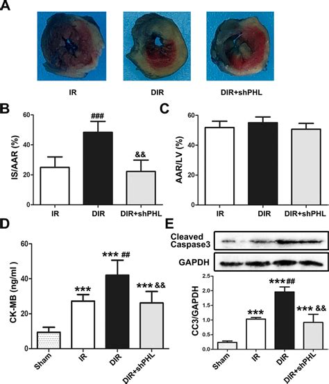 Myocardial Ischemia Reperfusion Ir Injury In Vivo A Heart Sections