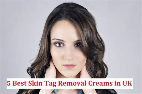 5 Best Skin Tag Removal Cream UK (Reviews & Comparison)