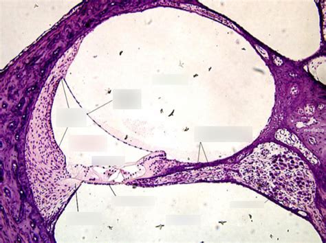 Inner ear Diagram | Quizlet