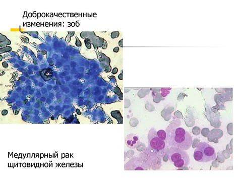 Возможности и методы цитологической диагностики. Клиническая цитология ...