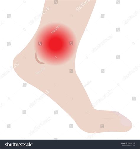 Swelling Feet Ankles Infected Injury Vector Stock Vector Royalty Free