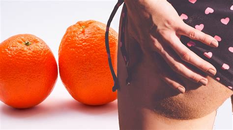 Cómo Llegar Al Verano Sin Celulitis ¡adiós A La Piel De Naranja