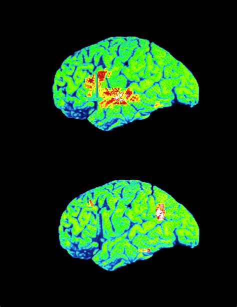 Coloured Pet Brain Scans When Recognising Words Photograph By Wellcome