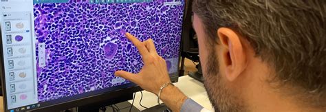 Digital Revolution In Pathology Luigi Vanvitelli University Hospital S