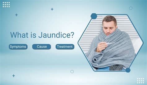 What Is Jaundice Symptoms Causes And Treatment Alfa Gastro